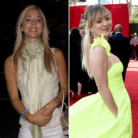 kaley cuoco tities|Kaley Cuoco Breast Implants: Her Plastic Surgery Transformation.